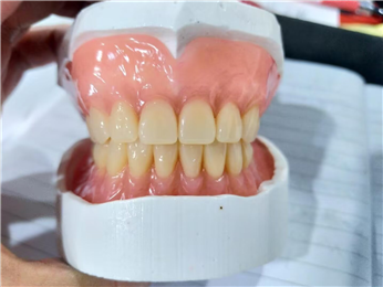 Dental Removable Complete Denture , Ivoclar Removable Complete Denture , Ivoclar Full Denture Acrylic Teeth